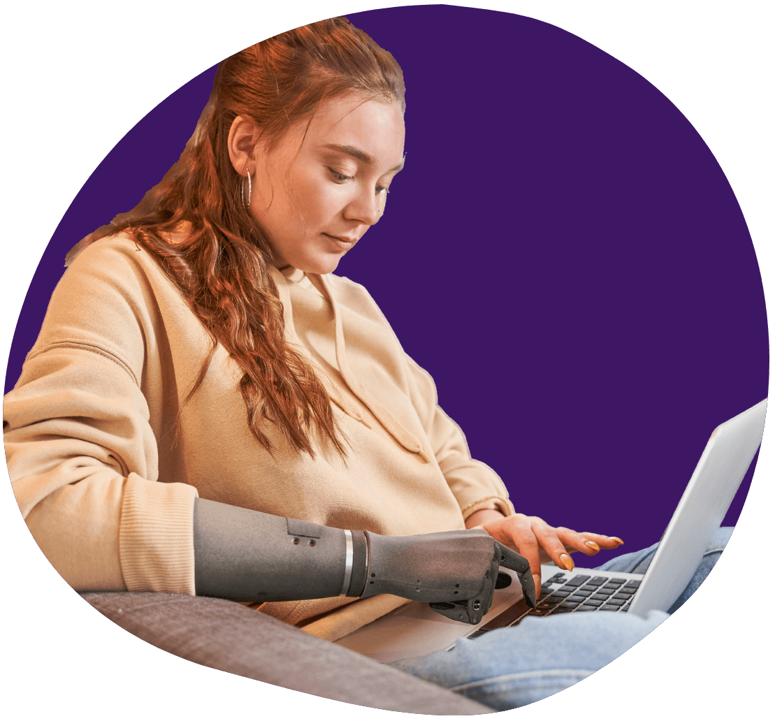Circular branded photo of a person with a prosthetic arm working on their sofa at home.
